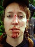 Picture of sab with nose broken by hunt thugs