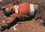 Boy Kurd Gassed By Saddam