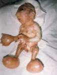 DEPLEATED URANIUM BABY