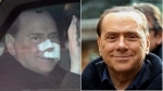 Berlusconi with/without bandages