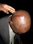 Man injured in police attack on community Nov 2009