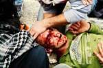Demonstrator injured by tear gas canister in Nabi Saleh December 2010