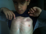 Yousuf reveals injuries following attack (09/08/12) by Brigitte Weaver. Mureck