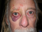 Disabled OAP attacked