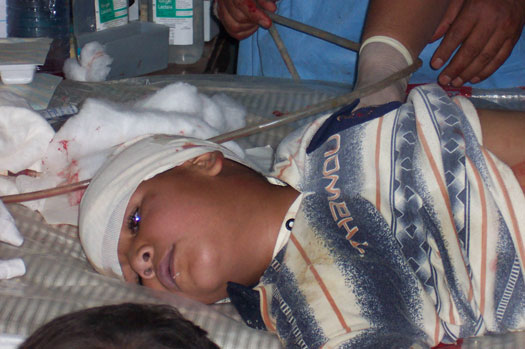 injured child with in Iraq