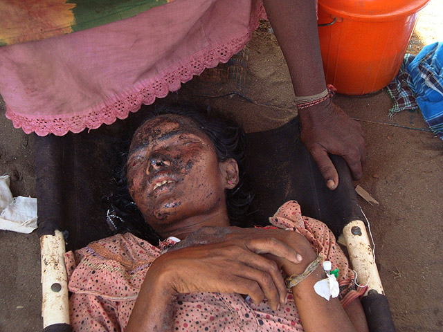 Body of a woman in Displacement Camp.